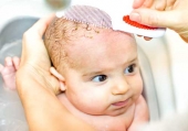 Crosta lattea neonato