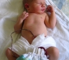 Lotus Birth